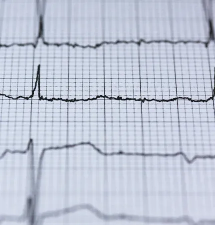 ECG et Holter ECG